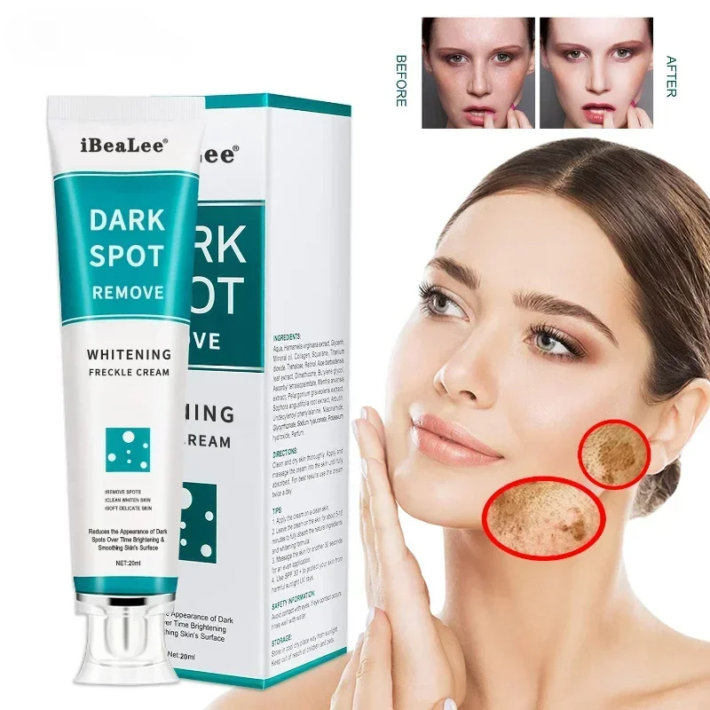 Skincare Glowing - Wybielający krem ​​do piegów Usuwa ciemne